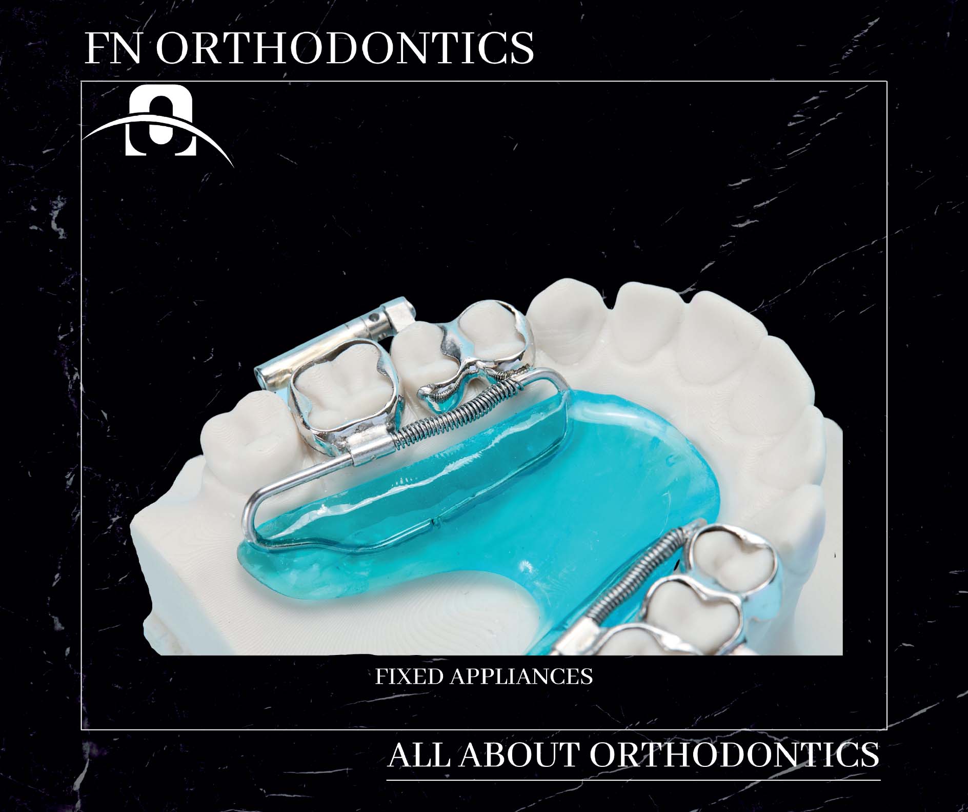 Fixed Appliances - Fn Orthodontics
