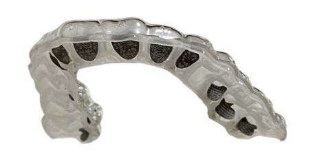 InBracket Customized Lingual Bracket System - FN Orthodontics