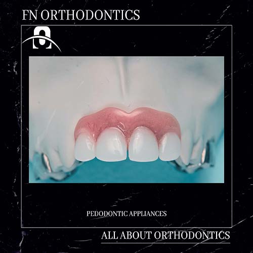 In the annual production line of F.N. Orthodontics, the pedodontic appliances occupy a significant percentage of the overall constructions.