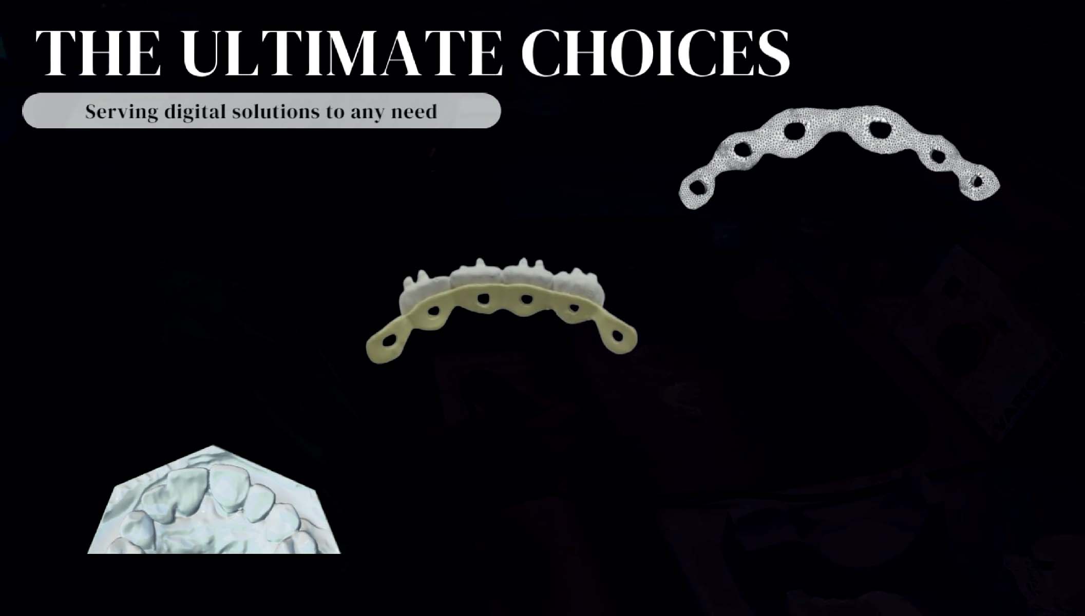 Retainers - FN Orthodontics